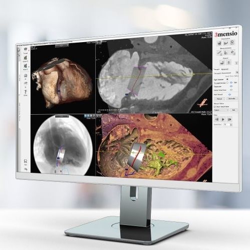图像分析软件 - Pie Medical Imaging - 报告 / 导入 / 医用
