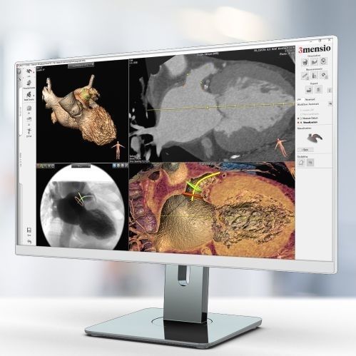 3D可视化软件模块 - Pie Medical Imaging - 诊断 / 规划 / 医用