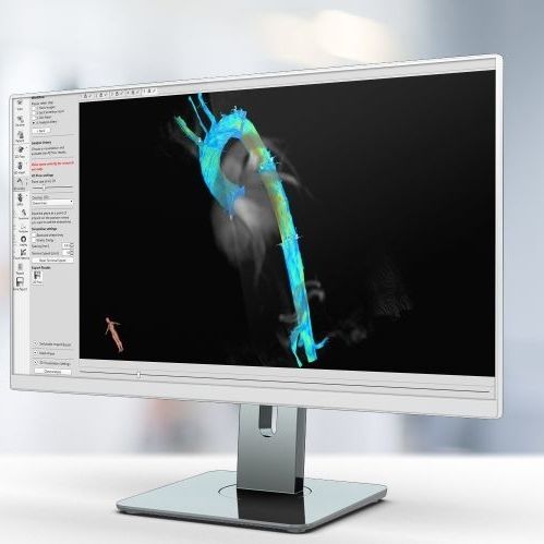 分析软件 - 4D Flow - Pie Medical Imaging - 可视化 / 规划 / 医用