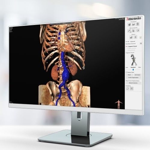 图像分析软件 - Pie Medical Imaging - 规划 / 加工 / 医用
