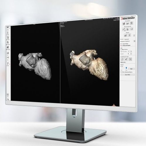 捕获软件 - Pie Medical Imaging - 3D 打印 / CT计算机断层扫描 / 用于研究
