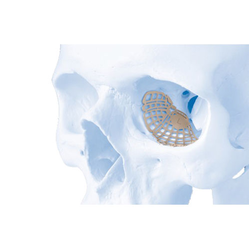 不可吸收眶部种植体 - MatrixORBITAL™ - Depuy Synthes/德普
