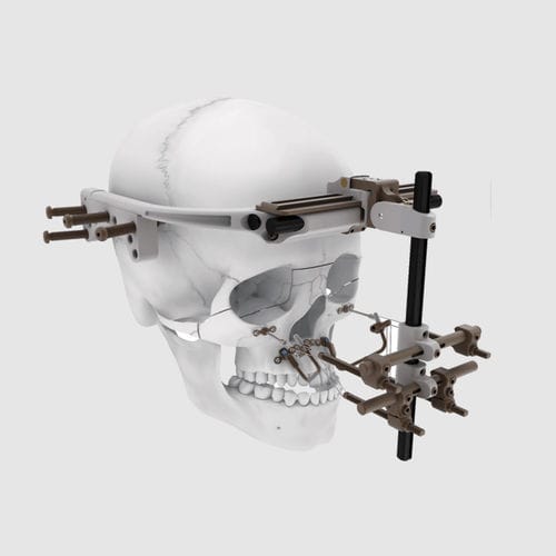 颌骨牵张器 - Depuy Synthes/德普 - 外部 / 儿科