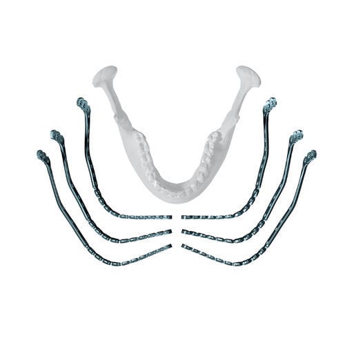 下颚加压接骨板 - MatrixMANDIBLE™  - Depuy Synthes/德普 - 远侧 / 锁定 / 金属