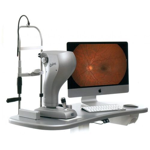 免散瞳眼底像机 - COBRA - CSO - Costruzione Strumenti Oftalmici
