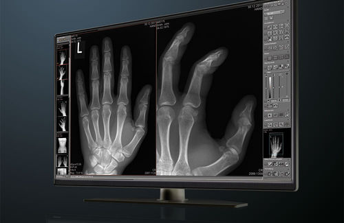 医疗管理软件 - dicomPACS® Basic - OR Technology - Oehm und Rehbein - 医学成像 / 核磁共振MRI