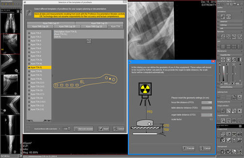 规划软件模块 - dicomPACS® vet Prosthesis  - OR Technology - Oehm und Rehbein - 用于骨科手术 / 兽用