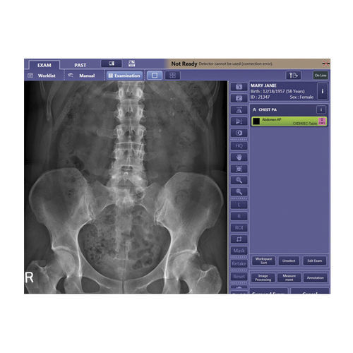 图像分析软件 - CXDI  - Canon Medical System U.S.A/佳能 - 控制 / 可视化 / 采集