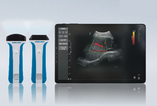 手持式B超机 - uREzpocus - Swissray - 用于多功能超声检查 / 黑白 / 彩色多普勒