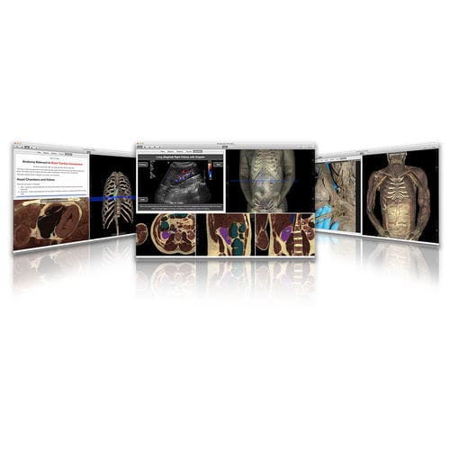 培训软件 - VH Dissector - Touch of Life Technologies (ToLTech) - 解剖学