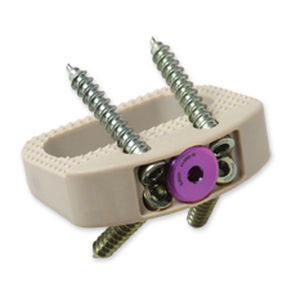 腰椎间融合器 - Vault® - Precision Spine - 前入路 / PEEK材质