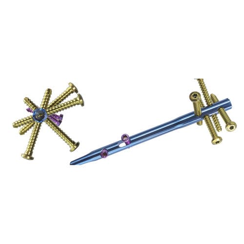 肱骨髓内钉 - AEQUALIS™ IM - Wright Medical Technology - 近端固定