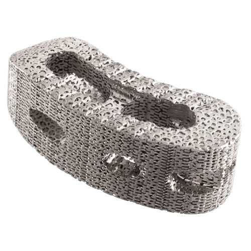 胸腰椎间融合器 - IdentiTi™-PC - Alphatec Spine - 后入路 / 钛