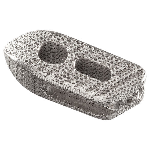 胸腰椎间融合器 - IdentiTi™-PO - Alphatec Spine - 后入路 / 斜行 / 钛