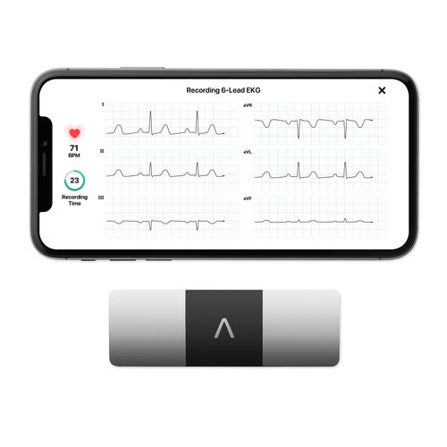 手持病人监护仪 - KardiaMobile® 6L - AliveCor - ECG / 居家护理 / 用于室外