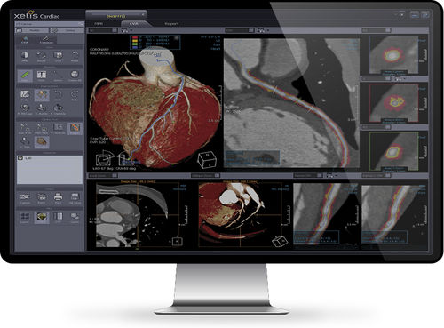 分析软件 - Xelis™ Cardiac - INFINITT North America - 3D 可视化 / 诊断 / 测量