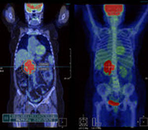 分析软件 - Xelis™ Fusion - INFINITT North America - 3D 可视化 / 多重模态图像融合 / 医学成像