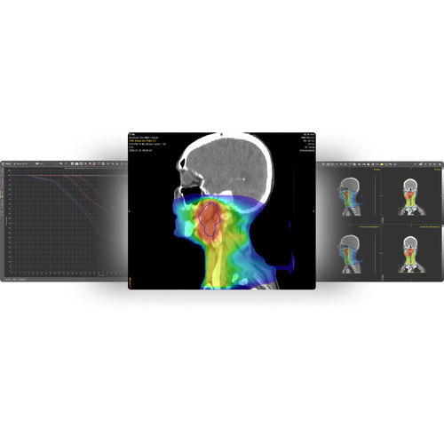 解剖学软件 - MIM SureCalc® MonteCarlo - MIM Software - 医学成像 / 辐射分量监护 / 测量