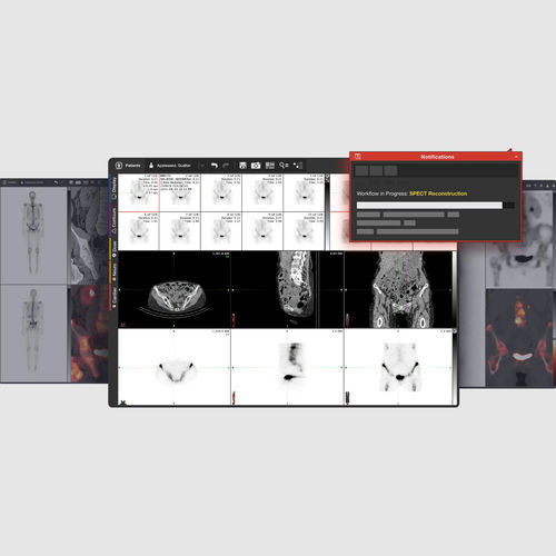 PET软件 - MIM Encore® - MIM Software - SPECT / 心脏 / 核医学