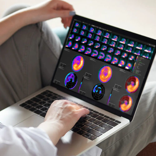 临床软件 - MIMcardiac® - MIM Software - CT计算机断层扫描 / PET / SPECT
