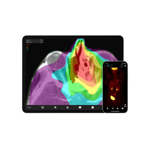 医学成像iOS应用程序 - Mobile MIM™ - MIM Software - 门禁 / 诊断 / iOS