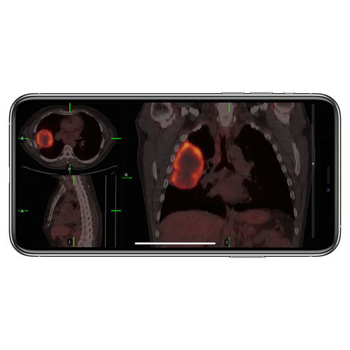 医学成像iOS应用程序 - VueMe™ - MIM Software - 门禁 / 导入 / iOS