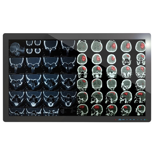医用显示器 - 4K2K - Richardson Electronics - Healthcare - 全高清Full HD / 4K分辨率 / 32"