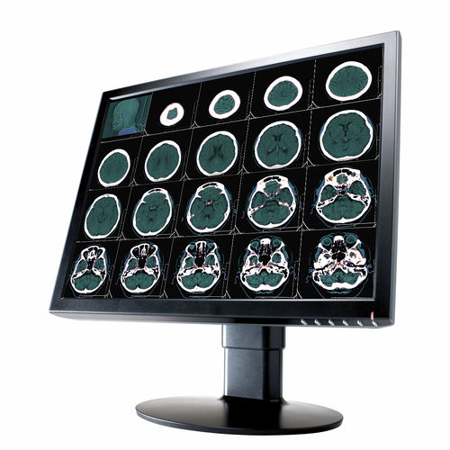 医用显示器 - 2 MP | CL2000 - Richardson Electronics - Healthcare - 诊断 / 用于放射学 / 20.1"