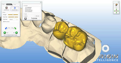 牙修复体设计软件 - ORIGIN HD - B&D Dental Technologies - CAD / CAM