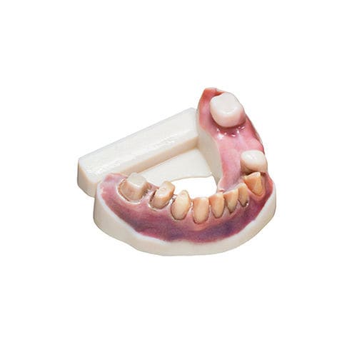 树脂材质牙科材料 - VeroVivid™ - Stratasys - 用于3D打印 / 半透明
