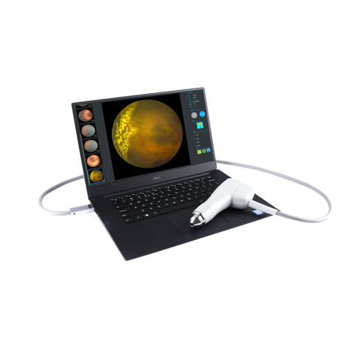 免散瞳眼底像机 - SW-8000P - Tianjin Suowei Electronic Technology - 眼部荧光血管造影术 / 手持式