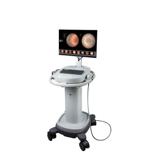 免散瞳眼底像机 - SW-8000 - Tianjin Suowei Electronic Technology - 眼部荧光血管造影术 / 推车式