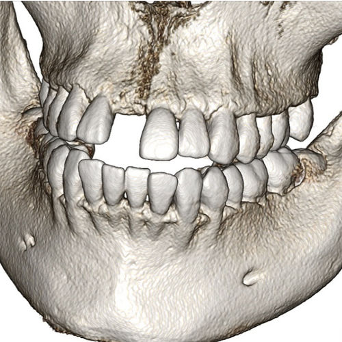 牙科软件 -  Invivo6 - Anatomage - 医用 / CT计算机断层扫描 / 分析