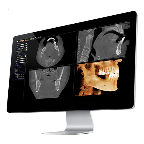 医用软件 - Invivo - Anatomage - CT计算机断层扫描 / PET / 通用