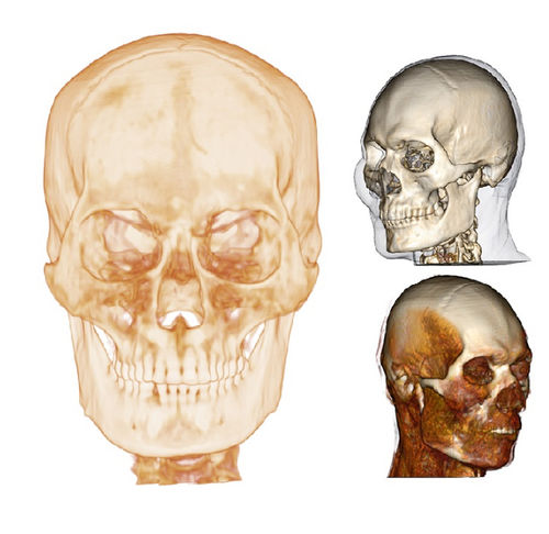 医用软件 - Medical Design Studio - Anatomage - 解剖学 / 3D 可视化 / 设计