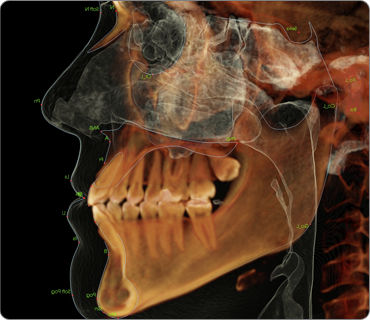 牙科造影软件模块 - Anatomage - 正畸 / 手术 / 用于头部测量分析