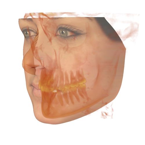 解剖学软件 - Anatomodel - Anatomage - 用于牙科造影 / DICOM文件 / 正畸