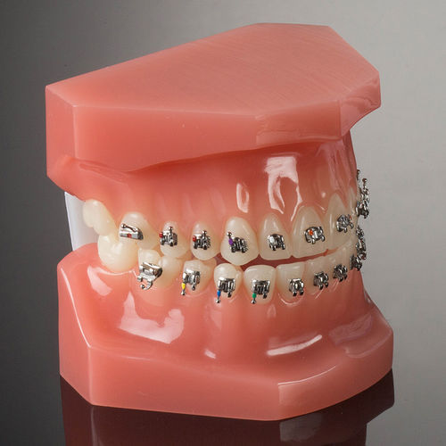 金属下颌正畸托架 - miniPrevail® - G&H Orthodontics - 双 / 小型