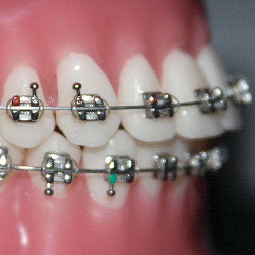 金属下颌正畸托架 - Focus™  - G&H Orthodontics - 小型