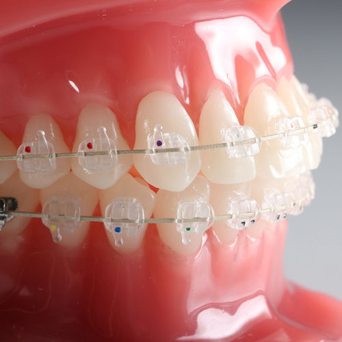 美容整形下颌正畸托架 - Vapor™ - G&H Orthodontics - 陶瓷 / 透明