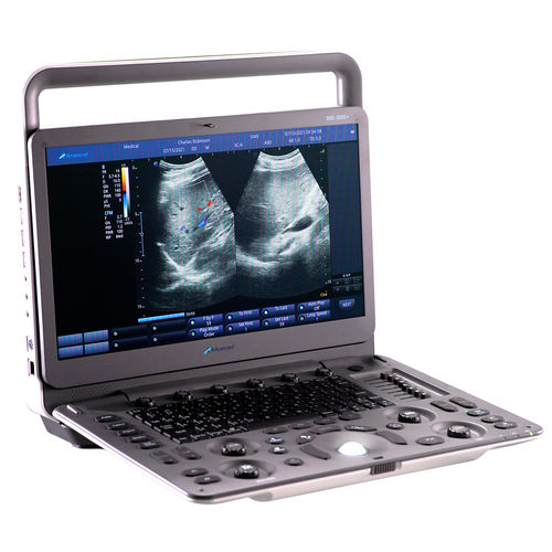 便携式B超机 - DUS – 5000 + - Advanced Instrumentations - 妇产科用超声成像 / 腹腔和盆腔超声成像 / 用于心血管超声检查