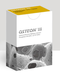 羟基磷灰石牙科材料 - OSTEON™ III - Genoss - 牙齿修复