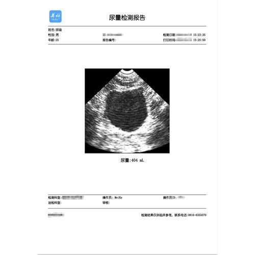 打印机软件 - Mianyang Meike Electronic Equipment - 安全防护型 / 验证 / 泌尿科