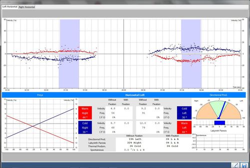 医学诊断软件 - PRO-Line  - Instrumentation DIFRA - 医用 / 脚