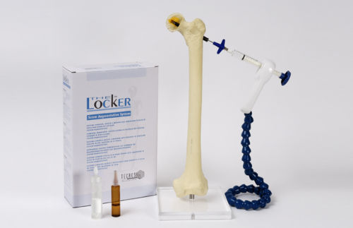 骨水泥注射器械套件 - Locker - Tecres - 一次性