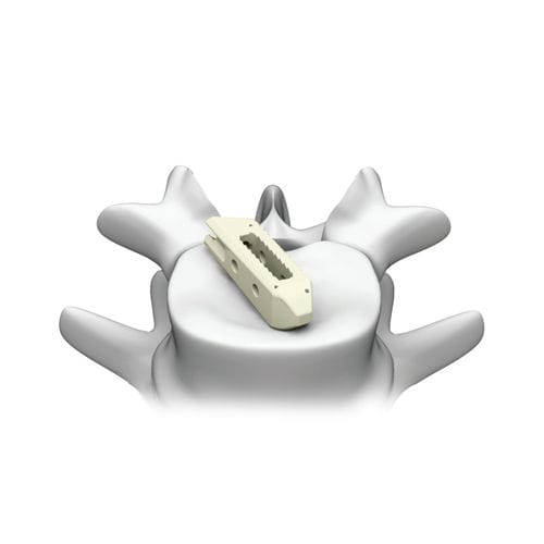 腰椎间融合器plateau03lo