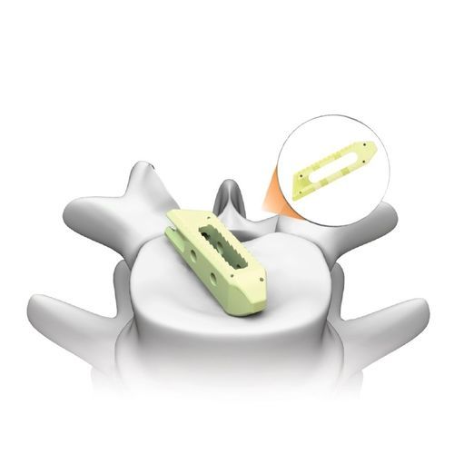 腰椎间融合器 - PLATEAU®-LO - Life Spine - 椎间孔内 / 斜行