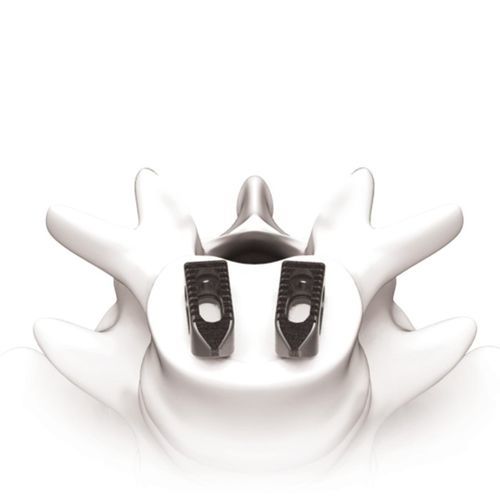 胸腰椎间融合器 - PLATEAU®-Ti - Life Spine - 前入路 / 钛