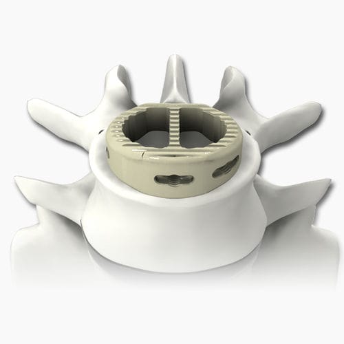 腰椎间融合器plateau03a