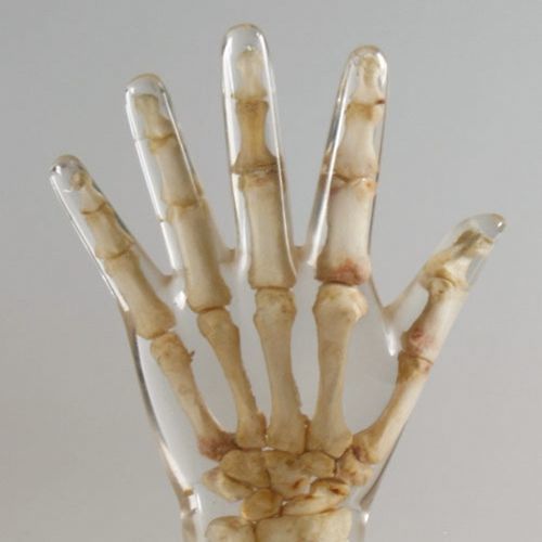 放射造影测试体模 - 12711 - QUART X-Ray QA Solutions - 用于荧光检查 / 手部